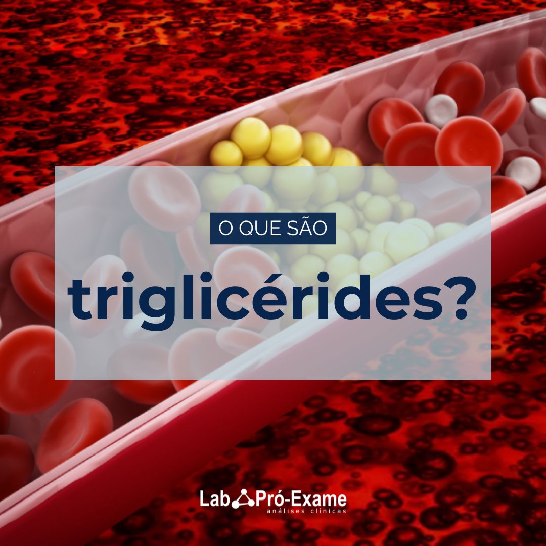 Triglicérides 