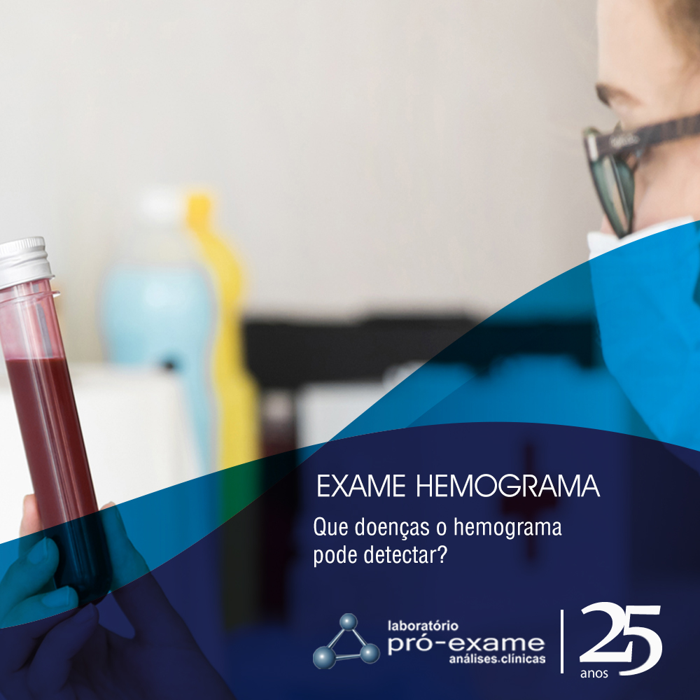 Exame Hemograma