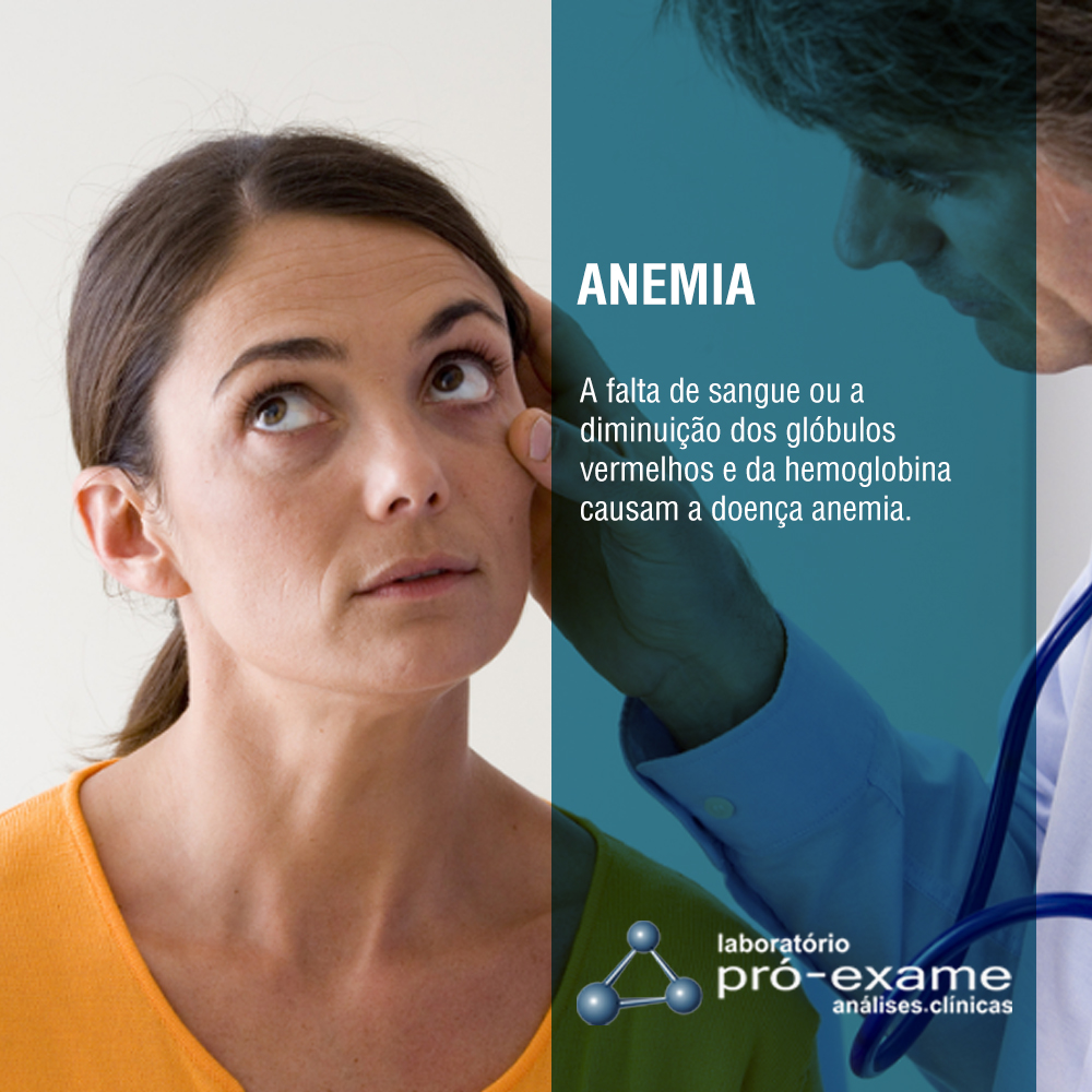 ANEMIA